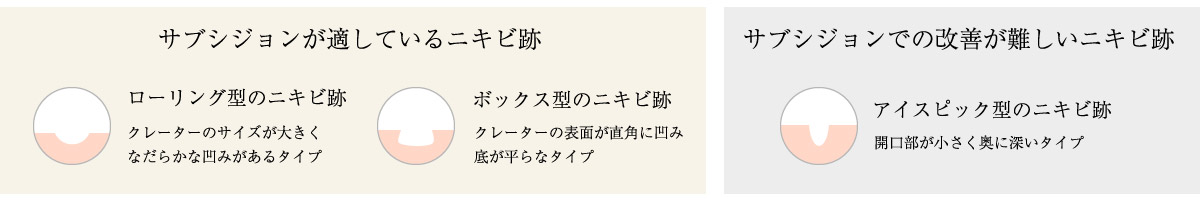 サブシジョンとは